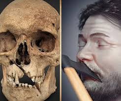 Skeleton of a 23 years old soldier who died in the battle of Waterloo.  1815. The bullet which killed him is still visible in his chest.