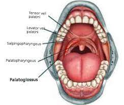 Contralateral spread is infrequent (10%).1. Anatomy Head And Neck Palatoglossus Muscle Glossopalatinus Palatoglossal Article