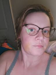 5 days post op. Still in pain, unable to do anything. Noticed I have yellow  bruising around 3 out of 4 of the incisions, just started 5 days after. Is  this normal