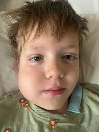 I thought my little boy, 7, had a wobbly tooth until his cheek swelled up  like a tennis ball