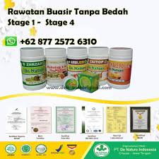 Tapi entah kenapa, tante linda tidak pernah mengatakan. Pelbagai Cara Ubat Buasir Ketika Hamil Semulajadi Merawat Buasir Punca Buasir Kempiskan Buasir Herba Buasir Ubat Buasir
