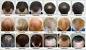 Castor Oil Before And After Hair Men