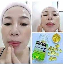 Vitamin e dietary supplements and other antioxidants might interact with chemotherapy and radiation therapy. Prolife Atlas Vitamin E Photos Facebook