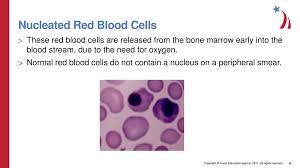 B cells occupy remaining 20% of the total lymphocytes present in the blood. Red Blood Cell Morphology Ppt Download