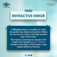 Image result for Refractive Error