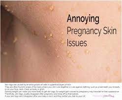 Pin On Healthy Skin Hair And Home