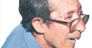 DÃa Nacional de la Juventud