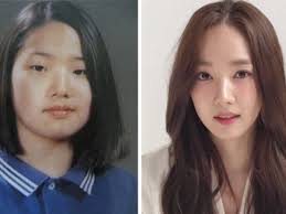 Airport, hong jinyoung, passport, plastic surgery, running man comments. Famous Korean Celebrities Who Undergone Plastic Surgery Hubpages