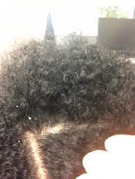 Dry and itchy scalps are more common than you might think. How Do You Tell The Difference Between Dry Scalp Flakes And Build Up Flakes Can T Figure Out How To Fix This Curlyhair