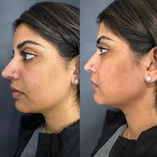 💖The dynamic duo! Own your beauty from the inside out!  Https://renewedbeautybysara.isagenix.com 💁🏼‍♀️Proudly providing services  to help clients of all ethnicities, ages, and genders soften the effects of  aging and imperfect skin while