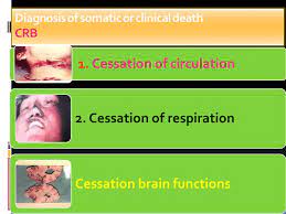Learn vocabulary, terms and more with flashcards, games and other study tools. Lecturer Forensic Medicine Mcst Ppt Video Online Download
