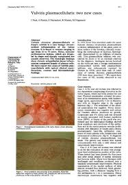 Image result for Vulvitis