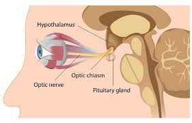 Pituitary Tumor Google Search Pituitary Gland Eye Exercises Gland