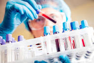 Laboratory Tests: MedlinePlus