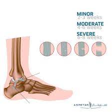 Severity Of Ankle Sprain Timeline Fracture Healing Healthcare Nurses Sprained Ankle