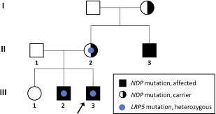 It is inherited in an. Planned Preterm Delivery And Treatment Of Retinal Neovascularization In Norrie Disease Ophthalmology