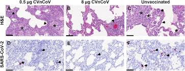 In der zweiten phase werden seit spätsommer 690 probanden in. Mrna Vaccine Cvncov Protects Non Human Primates From Sars Cov 2 Challenge Infection Biorxiv