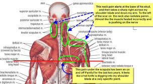 These muscles hold the neck portion of the spine in an upward position. Neck And Shoulder Muscles Diagram Diagram Base Website How To Relieve Neck Pain With Acupressure Five Pressure Points