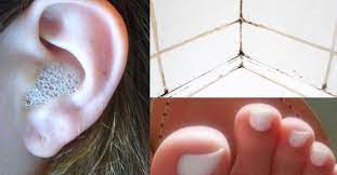 bewahrtes hausmittel 14 life hacks mit wasserstoffperoxid via genialetricks wasserstoffperoxid haushalt haushaltshilfe