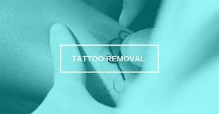 Premier vein & body by schwartz. Best Kansas City Laser Tattoo Removal Laser Derm Med Spa Shawnee