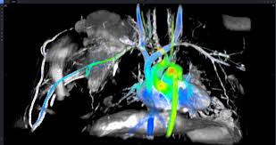 Image result for Cardiac MRI