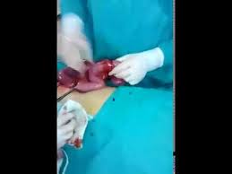 Cerita sedih harini tentang maggi ketam di pcb. Keburukan Maggi Youtube