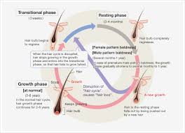 Hair at the top of the head also thins, often progressing to baldness. Aderans Company Limited Research Development Alopecia
