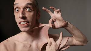 Stretchiest Skin In The World