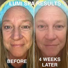 Just got a facial at Glowing Aura Wellness Spa. I highly recommend and  there is a sale