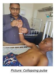 Image result for Collapsing Pulse