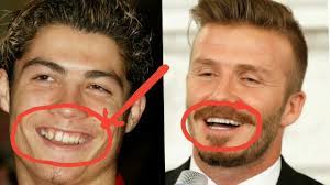 Invisalign braces are available now and they provide celebrities with the ability to correct their smiles covertly, but we should never forget about these beautiful people who. 20 Celebrities Before And After Braces Youtube