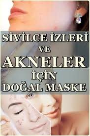 Hemen Hemen Herkesin Sorunu Olan Sivilce Cilt Gozeneklerini Tikayarak Olusur Olusmasini Engellemek Icin Dogal Yonte Skin Pores Face Makeup Concealer Acne Skin