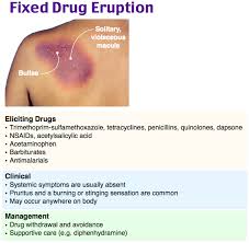 Fixed Drug Eruption Dermatology Nurse Medical Knowledge Pediatric Nurse Practitioner