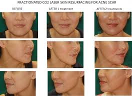 Plastic surgery is a medical specialty concerned with the correction or restoration of form and function. Dr Ananda S Cosmetic Surgery Clinic In Kota Damansara Malaysia Read 21 Reviews