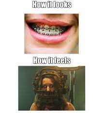 23 Pictures That Will Send Chills Down Your Spine If You Had Braces Dental Braces Dental Braces Colors Cute Braces