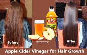 An anecdotal evidence stating that apple cider vinegar rinse stimulates better circulation to the hair follicles, which strengthens the hair roots and promotes a healthy hair growth. How To Apply Apple Cider Vinegar For Hair Growth