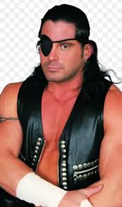 I wonder what happened to Dwight's eye? Wrong and right answers only.