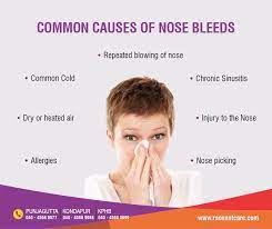 Common Causes Of Nose Bleed Https Raosentcare Com Bleeding From Nose Epistaxis Nose Bleeds Chronic Sinusitis Nose Bleeds What Causes