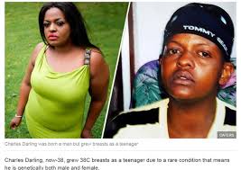 13歲男孩長出C罩杯？ 罕病讓「他」變雙性| ETtoday新奇新聞| ETtoday新聞雲