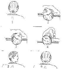 Image result for Canalith Repositioning Procedure