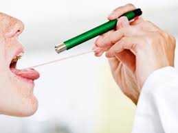 Streptococcal Screen Purpose Procedure And Results