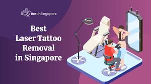 For costs, tammy's first session. The Top 12 Clinics For Laser Tattoo Removal In Singapore 2021