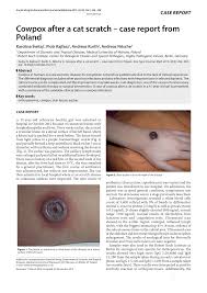 From wikipedia, the free encyclopedia cowpox is an infectious disease caused by the cowpox virus. Pdf Cowpox After A Cat Scratch Case Report From Poland