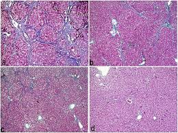 Image result for Aeschynomene elaphroxylon