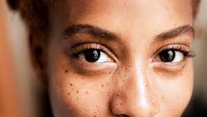 What do people mean by pain behind the eyes? 8 Eye Issues You Should Never Ignore Right As Rain By Uw Medicine