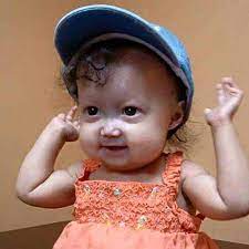 From round rock, texas, adalia rose has been a public figure with just as many facebook fans as george strait and willie nelson combined. Facebook
