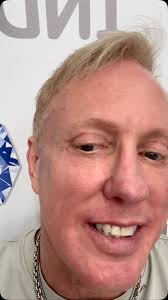 Day 36 Post-Op, The healing continues…, Face looking snatched, but now my  neck wants to join the drama! Tightening has started — and yep, it’s part  of the process. Every day I’m learning more about ...