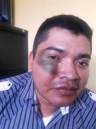 La Municipalidad de Coatepeque ante el hecho sucedido, el jueves 13 de  febrero 2020, en la 6a. Calle zona 1, área comercial de la ciudad de  Coatepeque, en donde el agente de