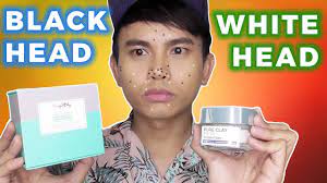 Pengobatan dengan menggunakan lidah buaya, anda akan mendapatkan banyak. Whitehead Blackhead Nak Tau Penyelesainnya Youtube