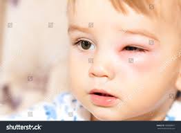 Bee Boy: Over 2,127 Royalty-Free Licensable Stock Photos